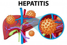 IDI Bagikan Informasi Pengobatan Penyakit Hepatitis