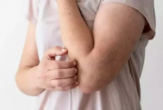 10 Tanda Di Kulit yang Bisa Jadi Gejala Diabetes