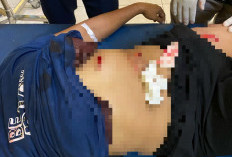 Kabawetan Kepahiang Berdarah, Diduga IRT Ditusuk hingga Dirawat di Rumah Sakit
