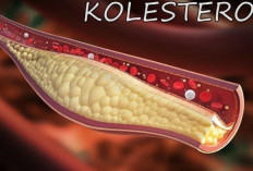  3 Obat yang Ampuh Menurunkan Kolesterol 