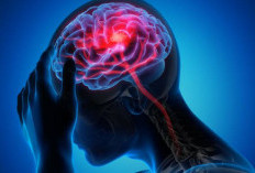 Diagnosis Kelainan Otak dengan Teknologi DSA, Ini Keunggulannya