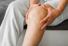 3 Obat yang Ampuh Meredakan Nyeri Asam Urat 