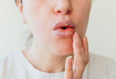  Berbagai Penyebab Bibir Bengkak, Gigitan Serangga hingga Angioedema