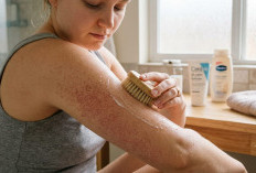 Agar Kulit Kembali Mulus, Ini Cara Mudah Mengatasi Keratosis