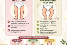 Kaki Bengkok Bayi Itu Normal Kok, Kenali Fakta dan Mitosnya