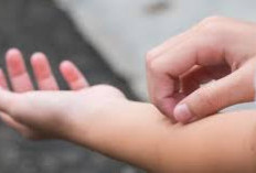 Kenali Berbagai Jenis Alergi Kulit pada Anak 