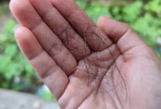 9 Tips Mencegah Rambut Rontok 
