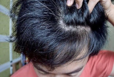 Apakah Uban Bisa Kembali Menjadi Hitam? Ini Penjelasannya