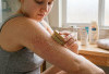 Agar Kulit Kembali Mulus, Ini Cara Mudah Mengatasi Keratosis
